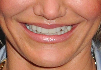 Most Recognizable Celebrity Smiles