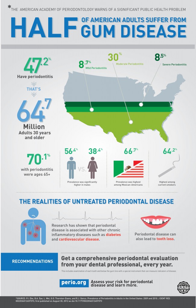 Half of Americans Suffer From Gum Disease: An Infographic