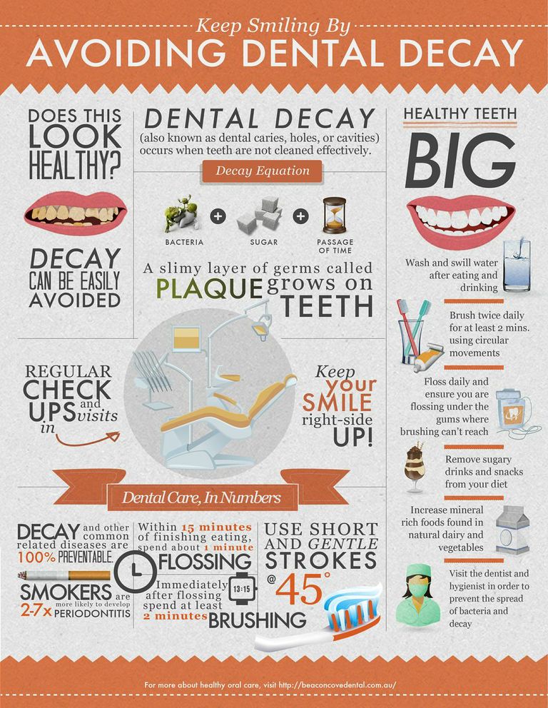 Avoiding Dental Decay: An Infographic