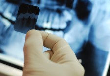 Question: Are Dental X-Rays Safe?