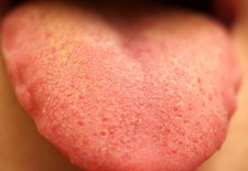 Why Is My Tongue Numb After Brushing?