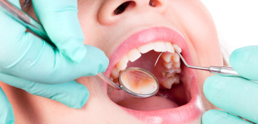 Myths and Facts about Amalgam Safety