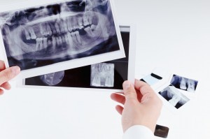 Dentist examining Xray