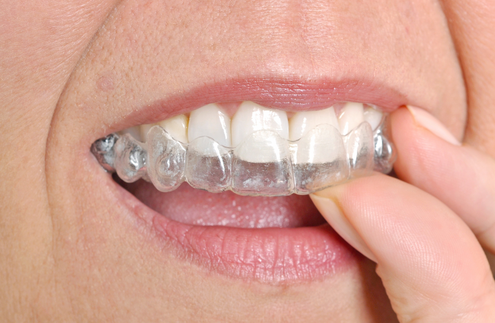 Easy and Simple Ways to Improve your Smile